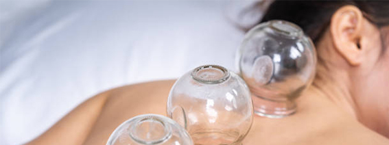 CUPPING THERAPY