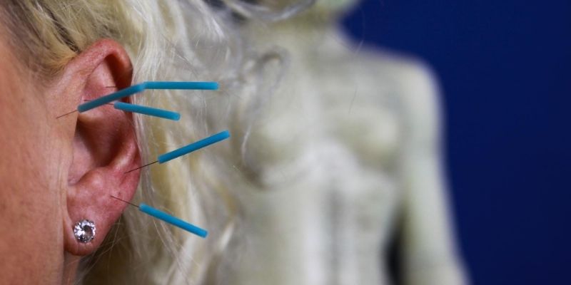 Kulak akupunktur noktaları üzerinden yapılan uyarımlar; zayıflama, ağrı kontrolü ve stres yönetiminde bedenin doğal iyileşme mekanizmalarını harekete geçirir.